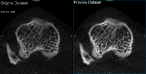 Filtering results