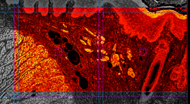 Overlapping regions