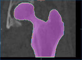 Contour meshes